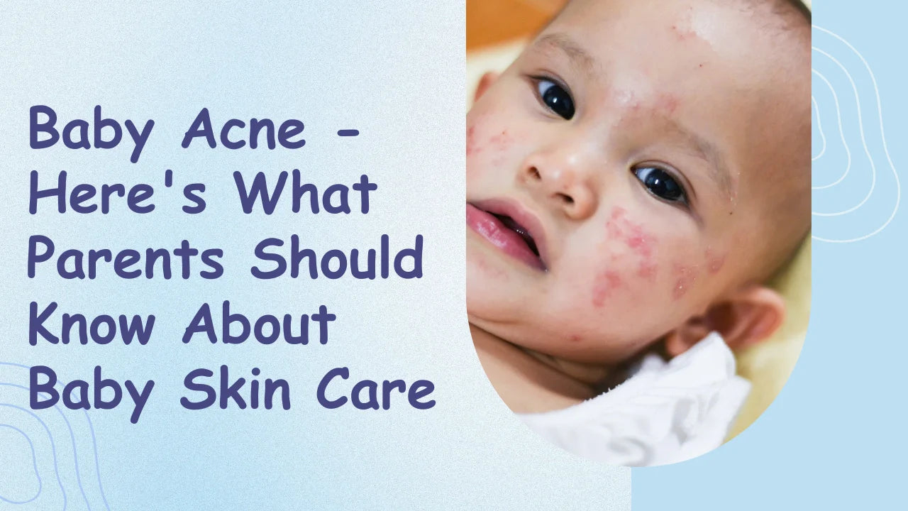Baby Acne - Here's What Parents Should Know About Baby Skin Care