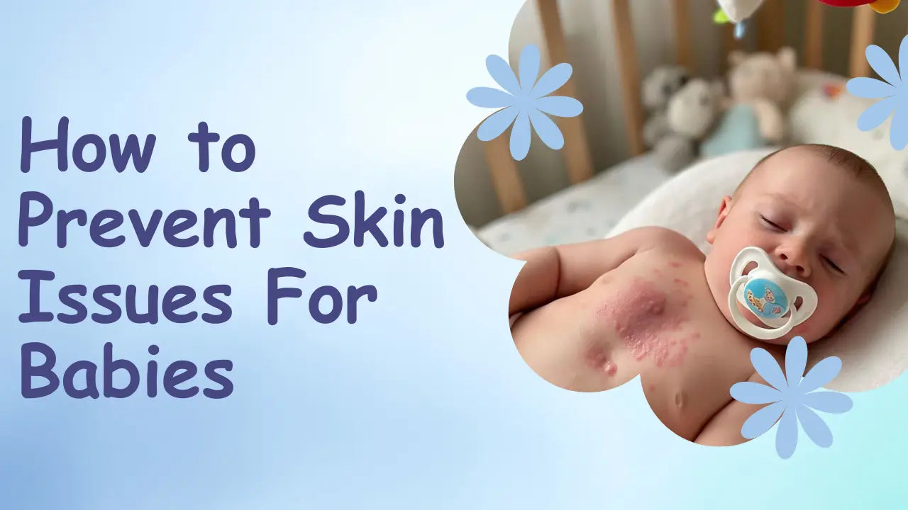 How to Prevent Skin Issues For Babies