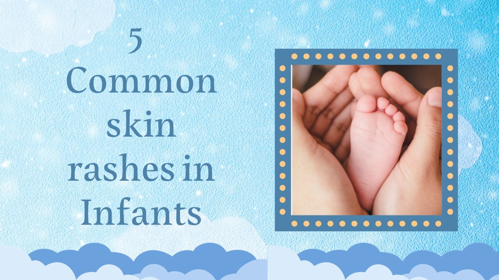 5 Common skin rashes in Infants